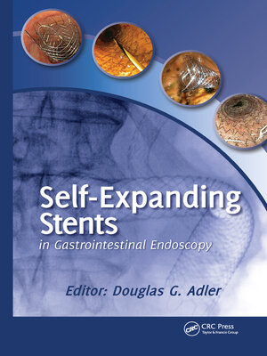 cover image of Self-Expanding Stents in Gastrointestinal Endoscopy